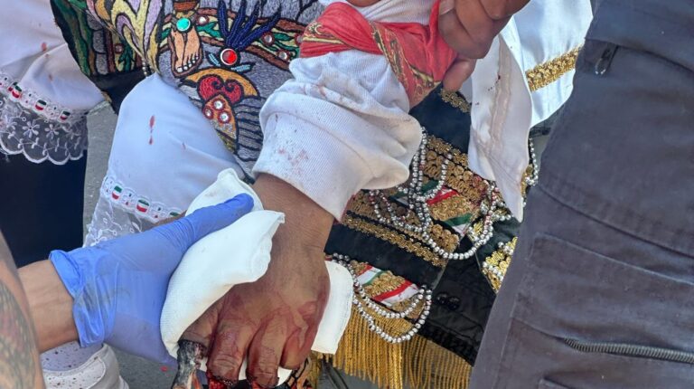 Se le acabó la fuerza de la mano izquierda, volaron dedos en Carnaval de Huejotzingo