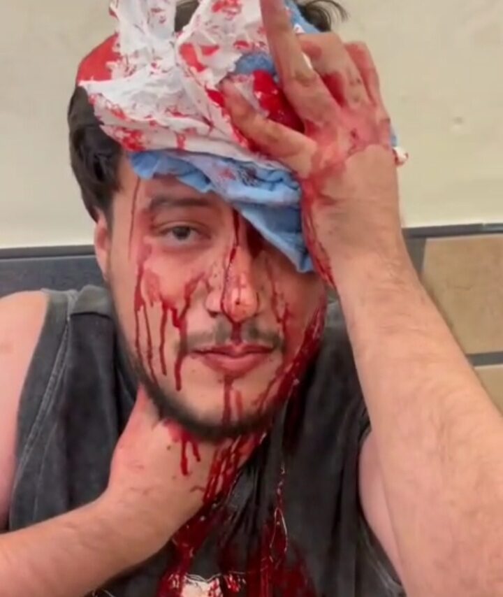 Homofóbico apuñala a puñal en La Oriental (VIDEO)