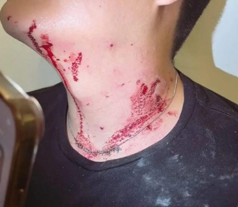 Dos lesionados en intentos de asalto en Cuautlancingo