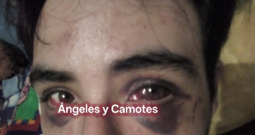 ¡El colmo! Pegasso pide 10 mil pesos y terapias a su hijo, lo acusa de traumarlo