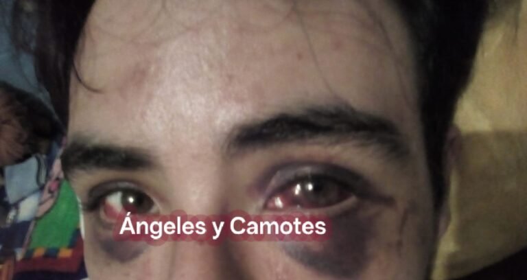¡El colmo! Pegasso pide 10 mil pesos y terapias a su hijo, lo acusa de traumarlo