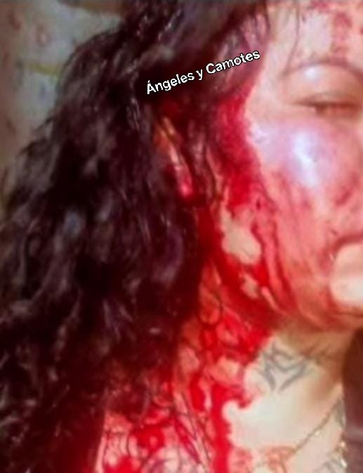 Tóxico le fractura el cráneo a su ex, por negarse a regresar con él 